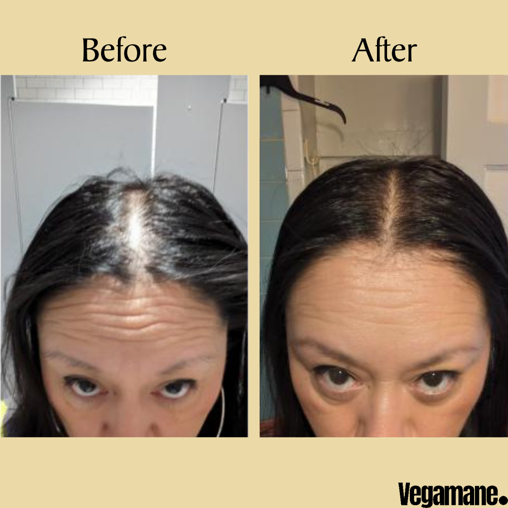 Vegamane™ - Rosemary Natural Hair Growth Oil (1+1 Free)