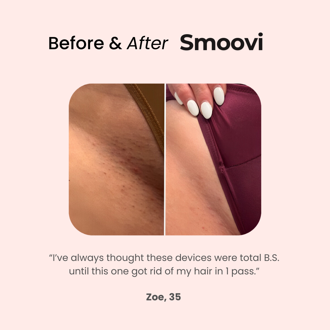 Smoovi™ - 2.0 Bikini Shaver (70% Off)