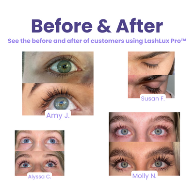 LashLux Pro™ - Lash Growth Serum (50% Off)